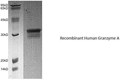 4279-1000-Veličina: 1 mg - Granzim a, ljudski rekombinantni, A. M. - svaki