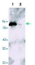 910303-veličina: 100 mikrograma - poliklonsko antitijelo kunića u odnosu na 96 91 - svako